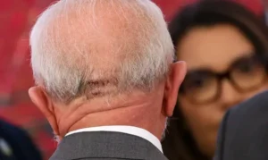 Em-19-de-outubro-Lula-sofre-uma-queda-e-bateu-a-ca-00941793-0-202412100724-ScaleDownProportional